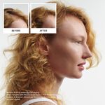 Nioxin System 4 Pro Clinical Proefpakket